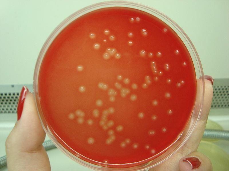 Streptococcus agalactiae streptokok skupiny B, v pochvě, v děloze, mohou způsobit těžkou infekci novorozence Streptococcus mutans obvykle v DÚ, přenáší se z dospělých na děti a napadá nově se