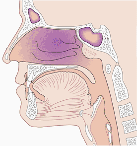 tonsilla tubae auditivae (v Eustachově trubici) tonsilla palatina (patrová