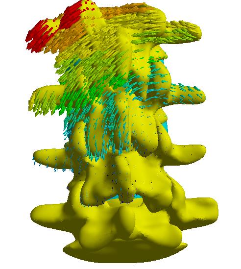 12.4 Laterární flexe Ohyb páteře do strany (laterární flexe) byl řešen pro zatížení Fz = -200N a My = 2500Nmm, Fz = -200N a My = 5000Nmm.