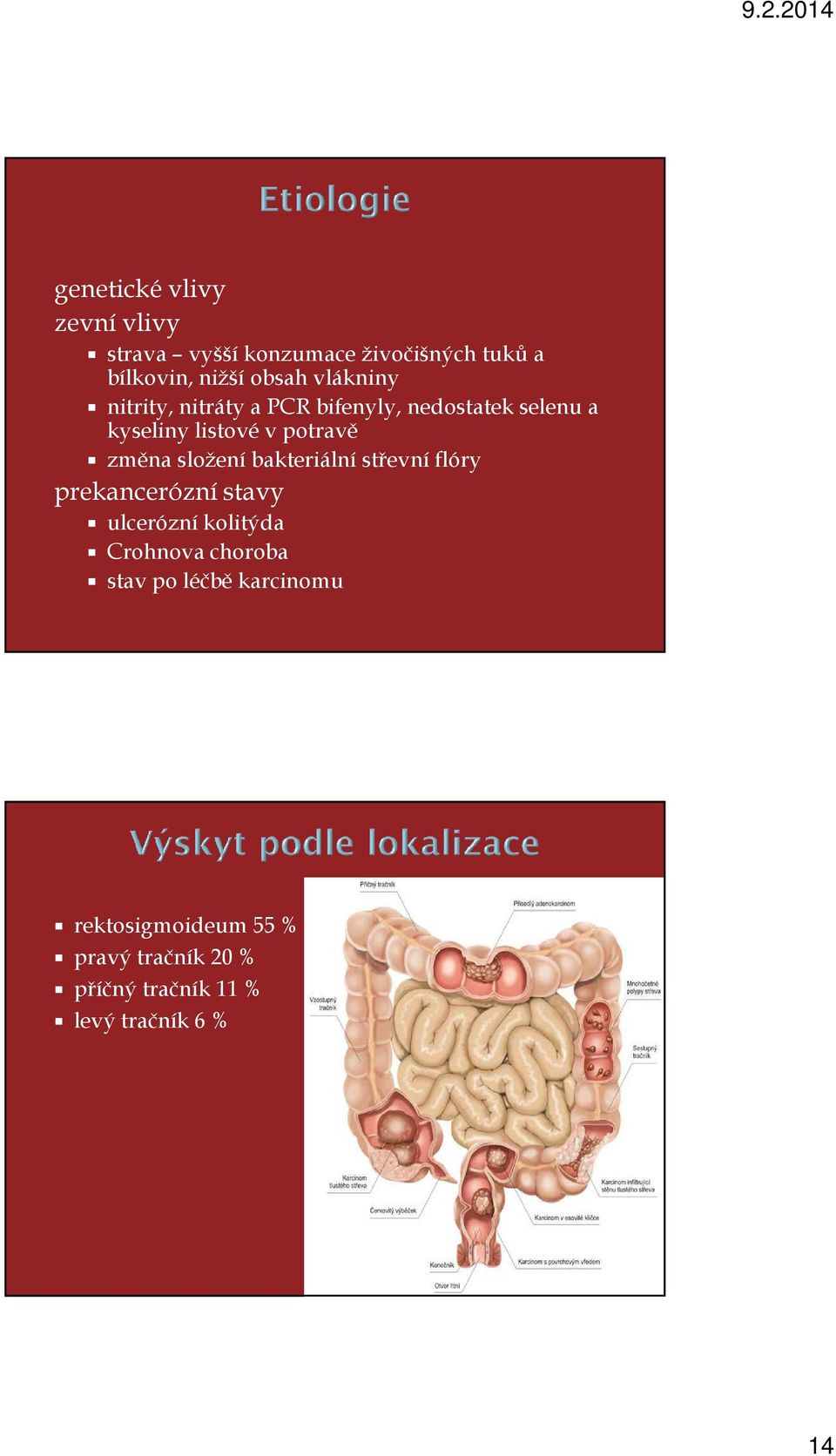 složení bakteriální střevní flóry prekancerózní stavy ulcerózní kolitýda Crohnova choroba stav