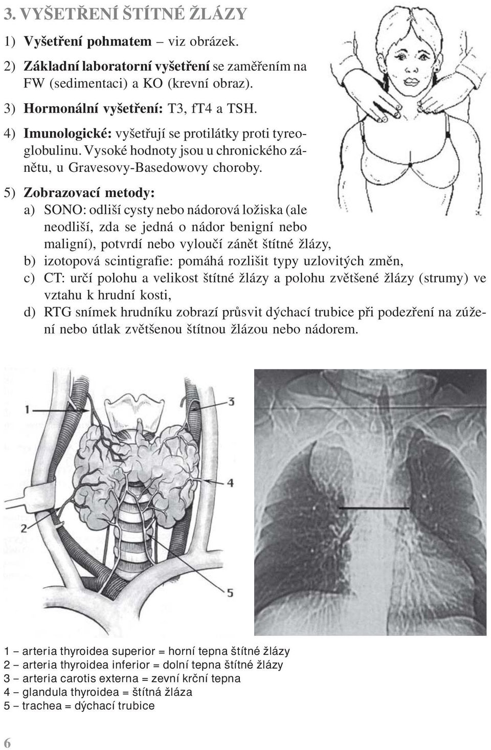 5) Zobrazovací metody: a) SONO: odliší cysty nebo nádorová ložiska (ale neodliší, zda se jedná o nádor benigní nebo maligní), potvrdí nebo vyloučí zánět štítné žlázy, b) izotopová scintigrafie: