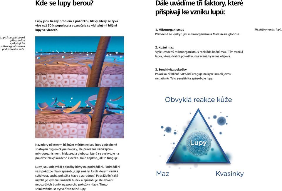 přirozeně se vyskytujícím mikroorganismem a podrážděním kůže. lupy ve vlasech. 1. Mikroorganismus Přirozeně se vyskytující mikroorganismus Malassezia globosa. 2.