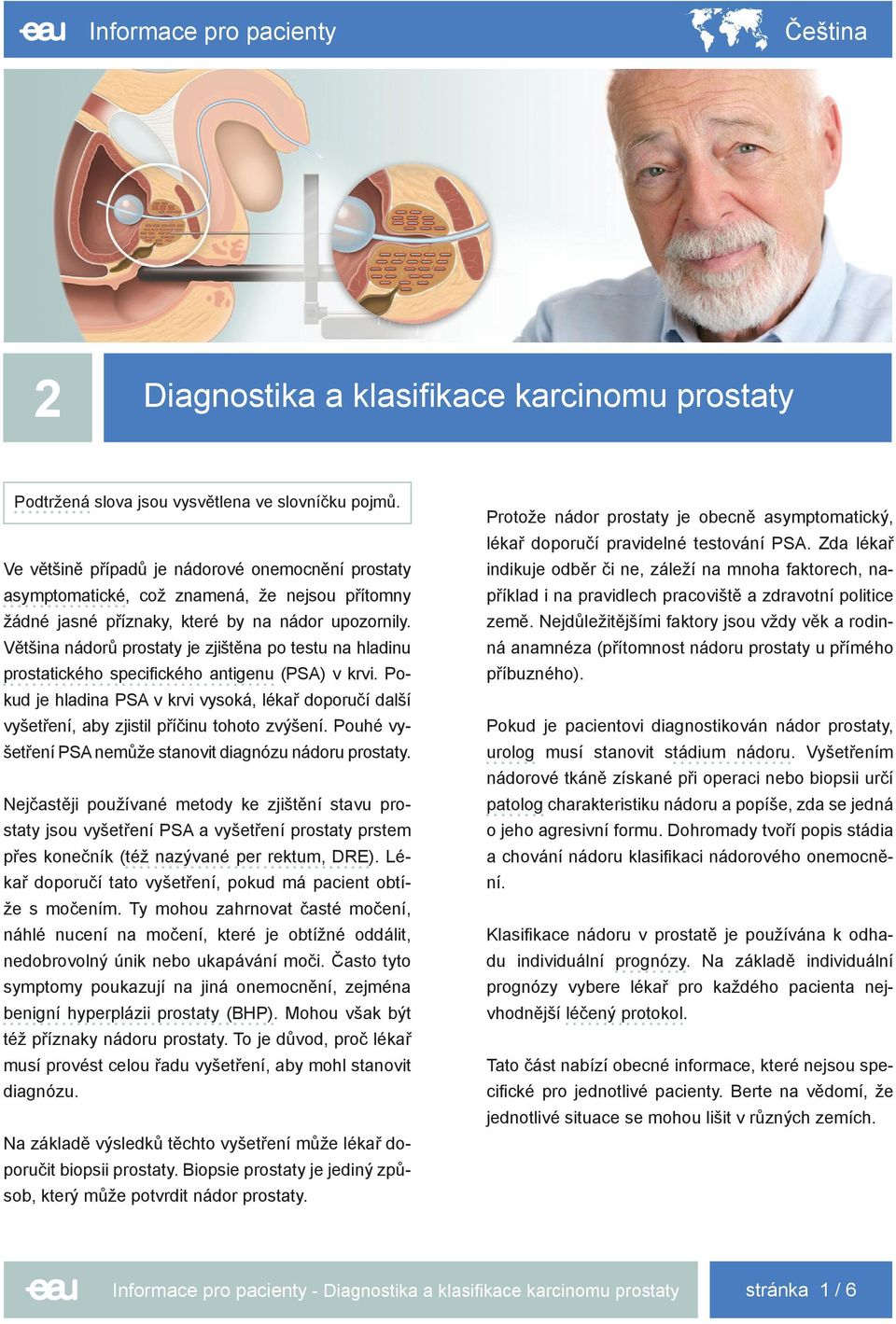 Většina nádorů prostaty je zjištěna po testu na hladinu prostatického specifického antigenu (PSA) v krvi.