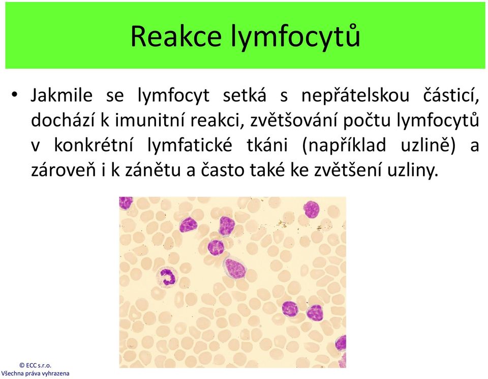 zvětšování počtu lymfocytů v konkrétní lymfatické tkáni