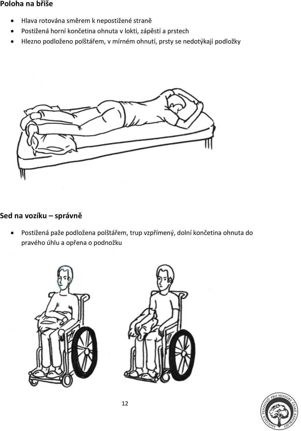 ohnutí, prsty se nedotýkají podložky Sed na vozíku správně Postižená paže
