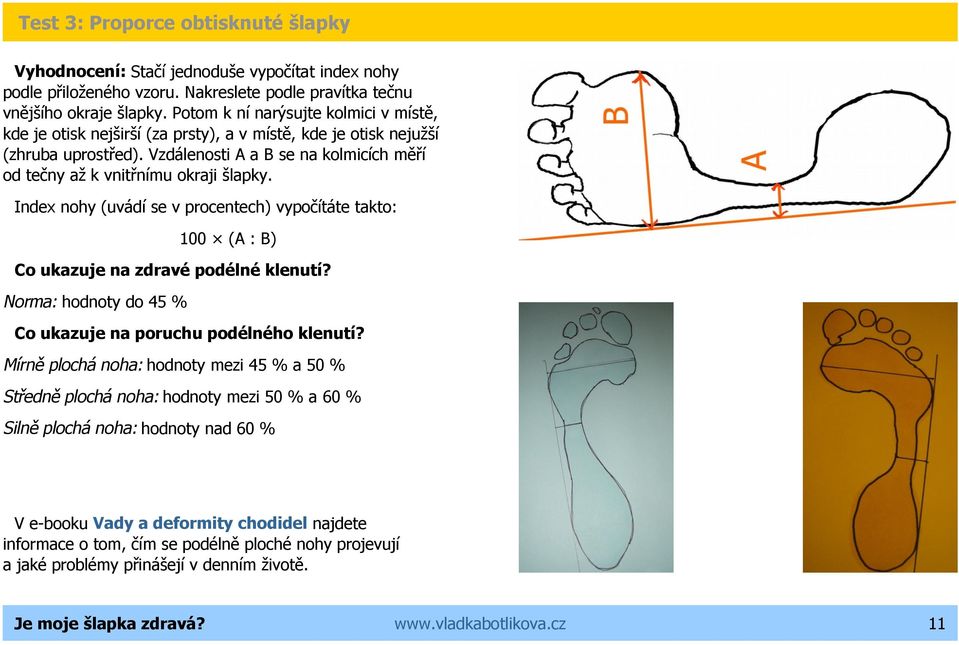 Vzdálenosti A a B se na kolmicích měří od tečny až k vnitřnímu okraji šlapky. Index nohy (uvádí se v procentech) vypočítáte takto: 100 (A : B) Co ukazuje na zdravé podélné klenutí?