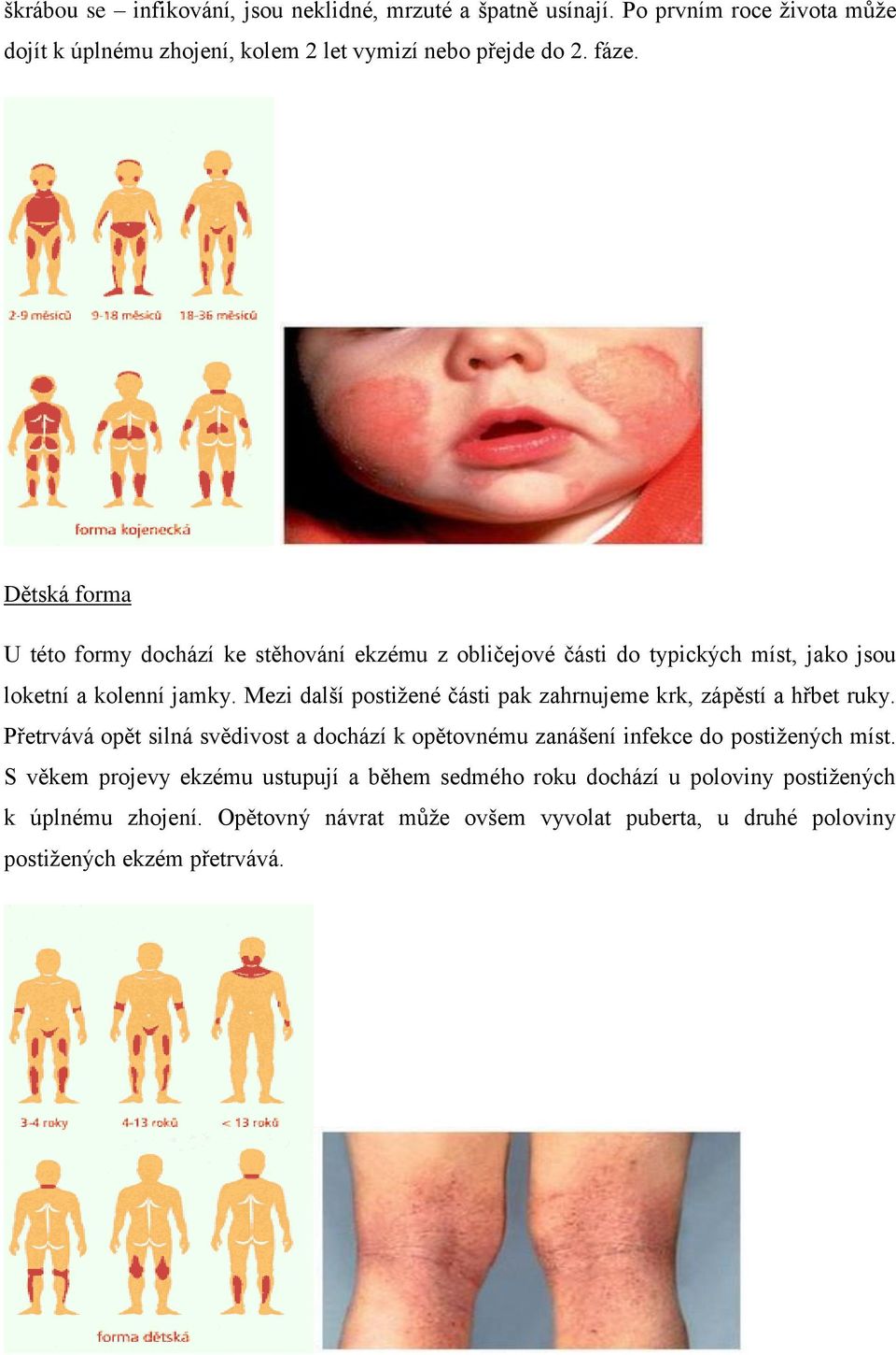 Mezi další postižené části pak zahrnujeme krk, zápěstí a hřbet ruky. Přetrvává opět silná svědivost a dochází k opětovnému zanášení infekce do postižených míst.