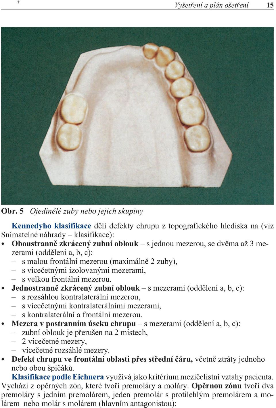 se dvìma až 3 mezerami (oddìlení a, b, c): s malou frontální mezerou (maximálnì 2 zuby), s víceèetnými izolovanými mezerami, s velkou frontální mezerou.