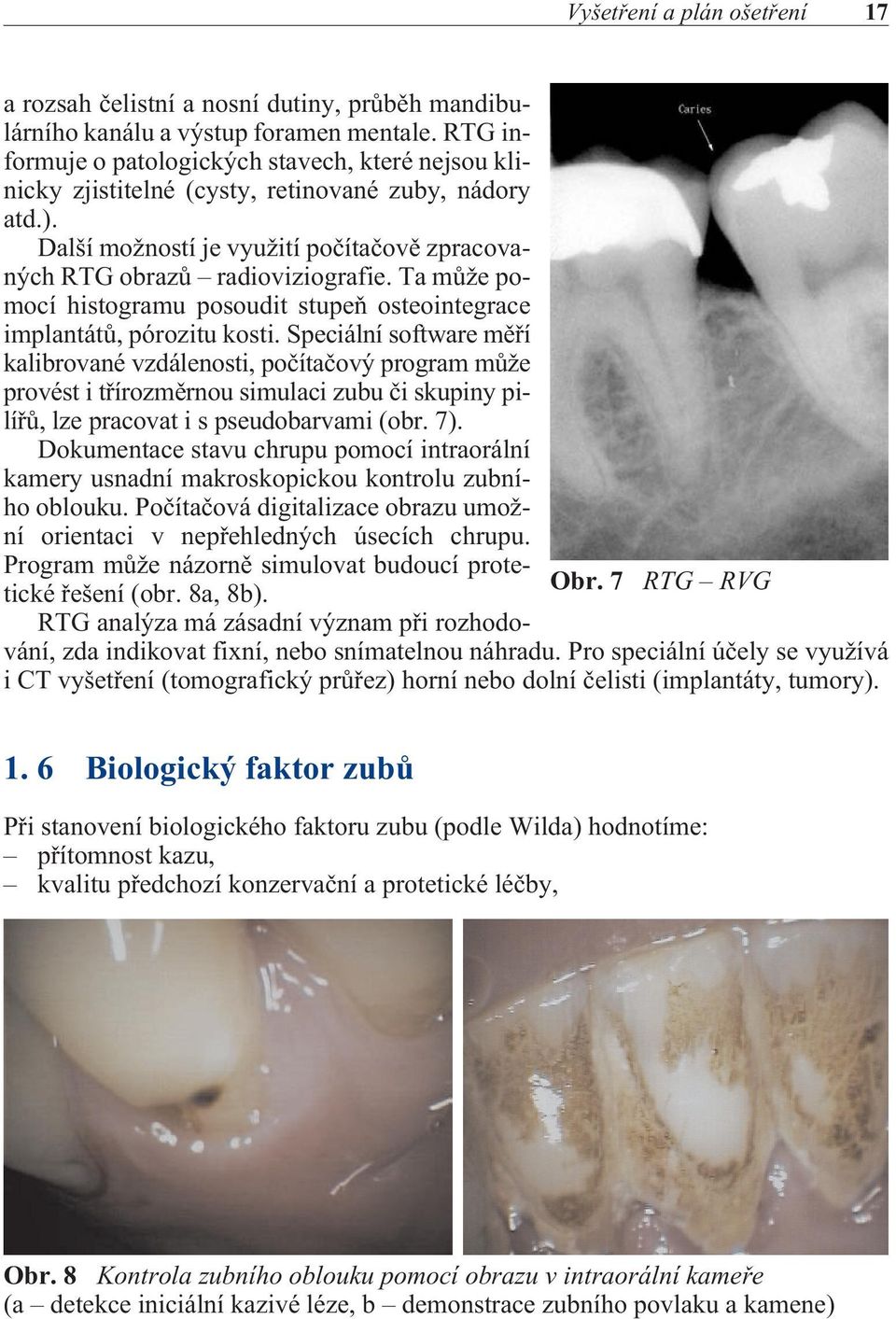 Ta mùže pomocí histogramu posoudit stupeò osteointegrace implantátù, pórozitu kosti.