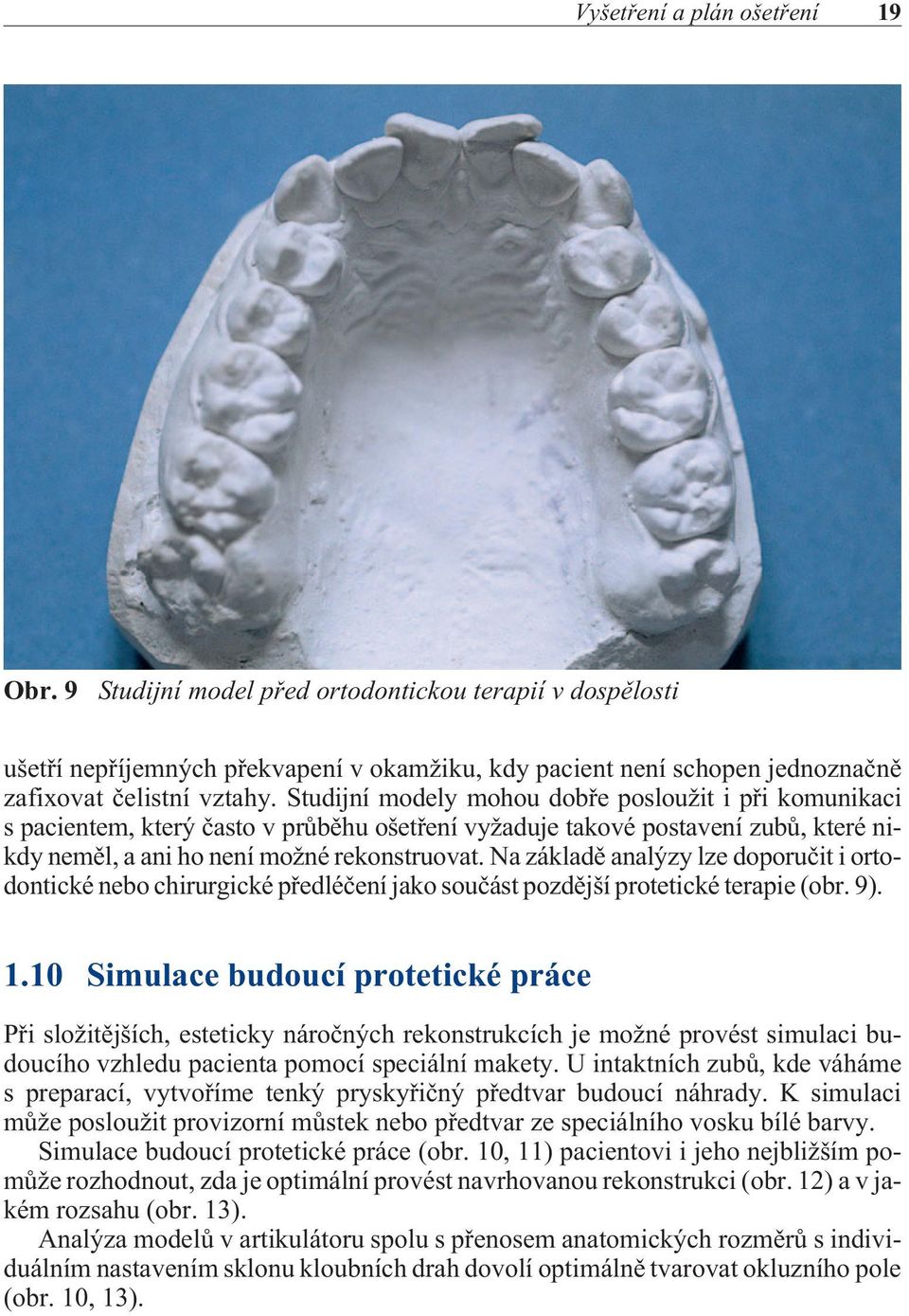 Na základì analýzy lze doporuèit i ortodontické nebo chirurgické pøedléèení jako souèást pozdìjší protetické terapie (obr. 9). 1.