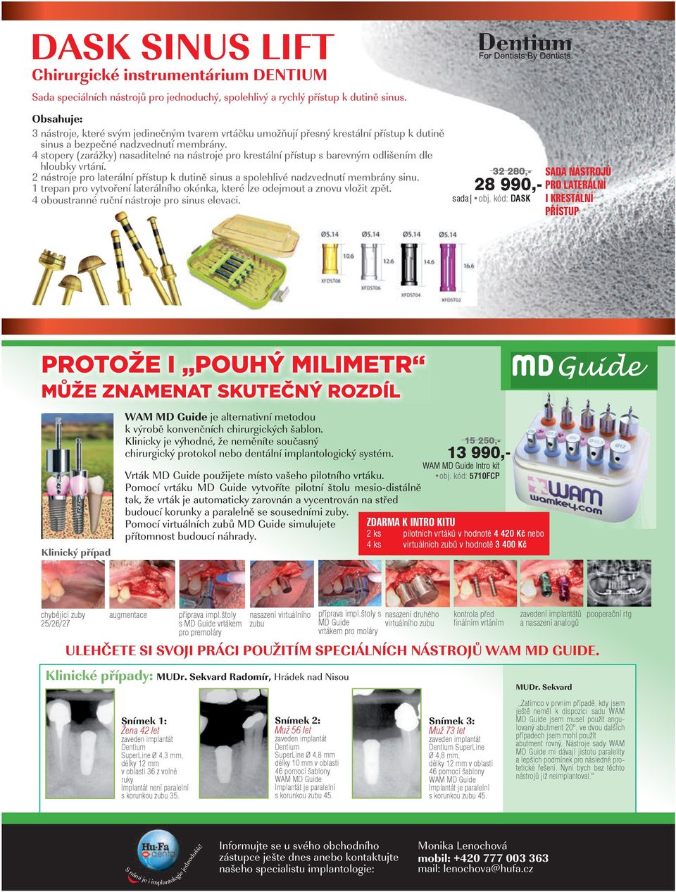 4 stopery (zarážky) nasaditelné na nástroje pro krestální přístup s barevným odlišením dle hloubky vrtání. 2 nástroje pro laterální přístup k dutině sinus a spolehlivé nadzvednutí membrány sinu.