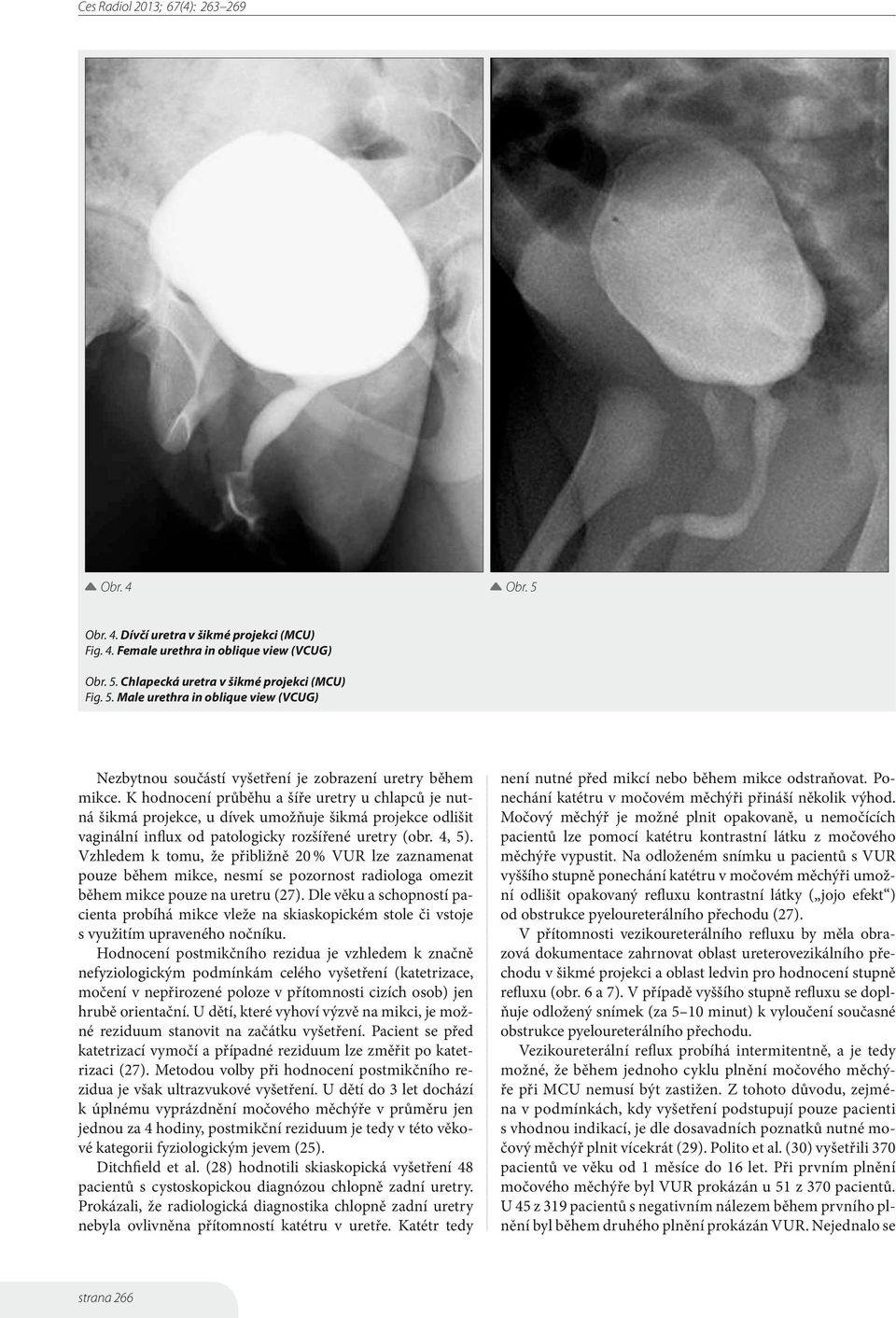Vzhledem k tomu, že přibližně 20 % VUR lze zaznamenat pouze během mikce, nesmí se pozornost radiologa omezit během mikce pouze na uretru (27).
