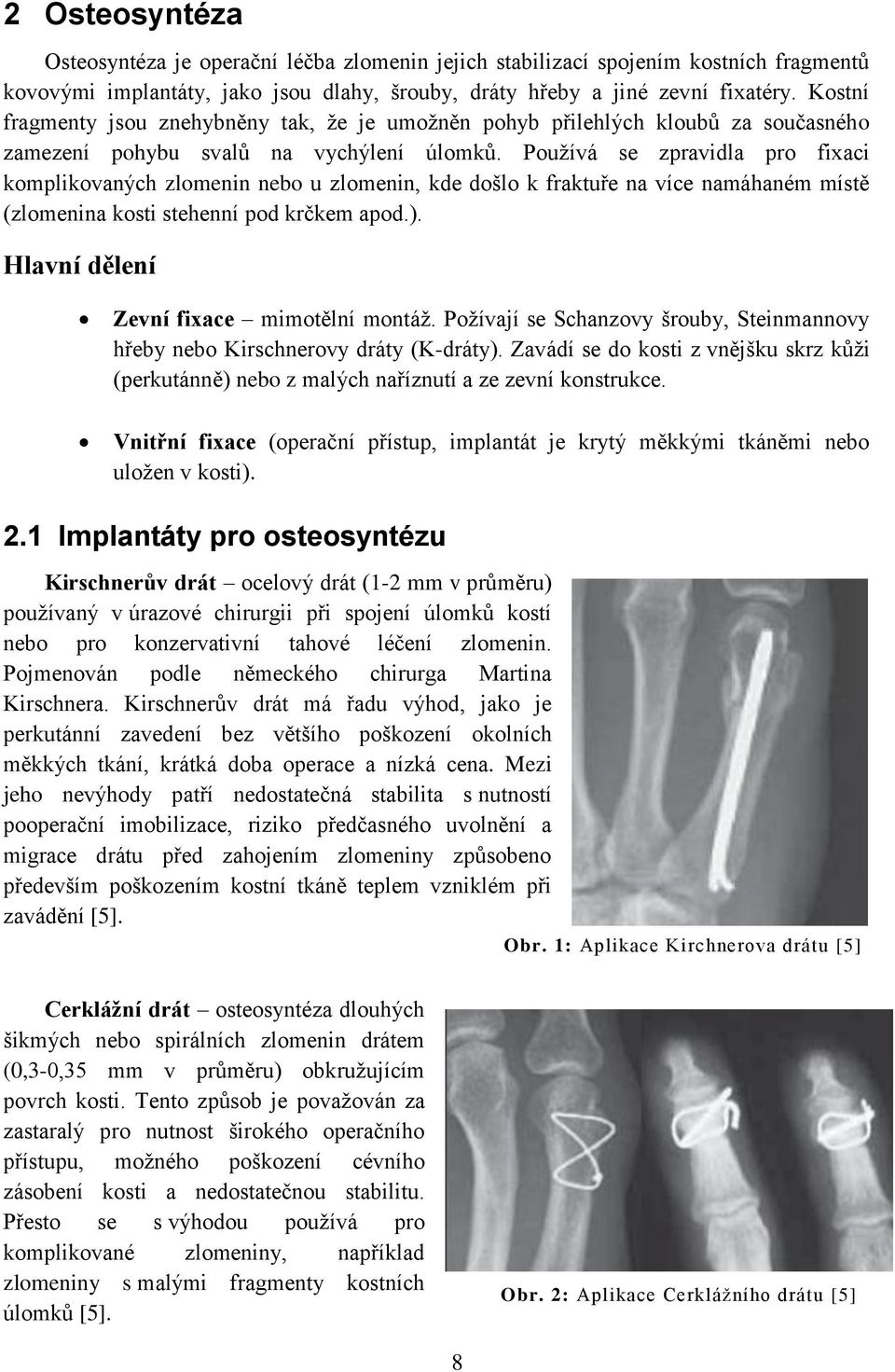 Používá se zpravidla pro fixaci komplikovaných zlomenin nebo u zlomenin, kde došlo k fraktuře na více namáhaném místě (zlomenina kosti stehenní pod krčkem apod.).