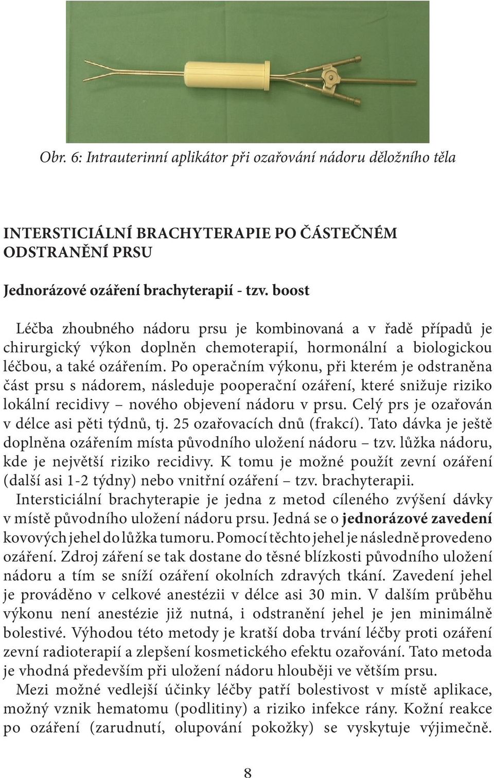 Po operačním výkonu, při kterém je odstraněna část prsu s nádorem, následuje pooperační ozáření, které snižuje riziko lokální recidivy nového objevení nádoru v prsu.