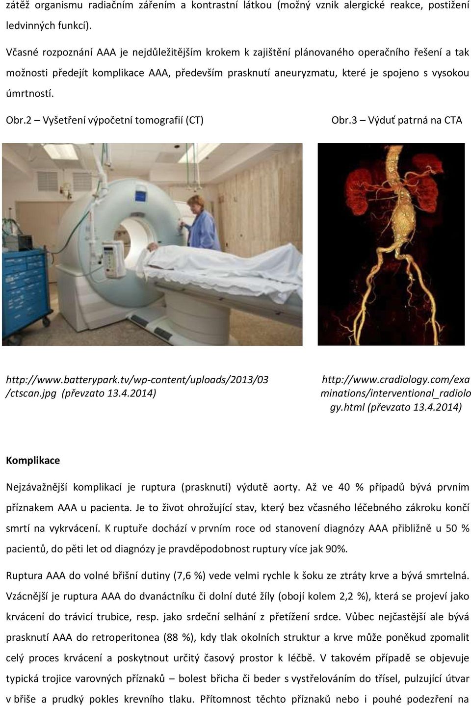 Obr.2 Vyšetření výpočetní tomografií (CT) Obr.3 Výduť patrná na CTA http://www.batterypark.tv/wp-content/uploads/2013/03 /ctscan.jpg (převzato 13.4.2014) http://www.cradiology.