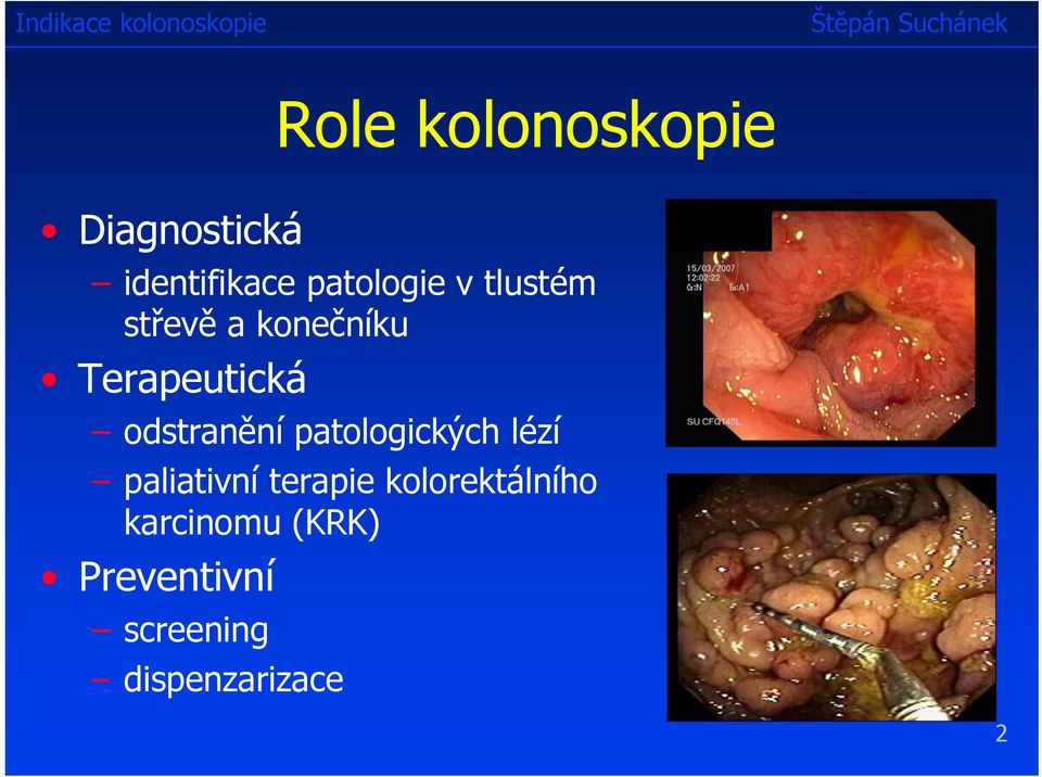 patologických lézí paliativní terapie kolorektálního