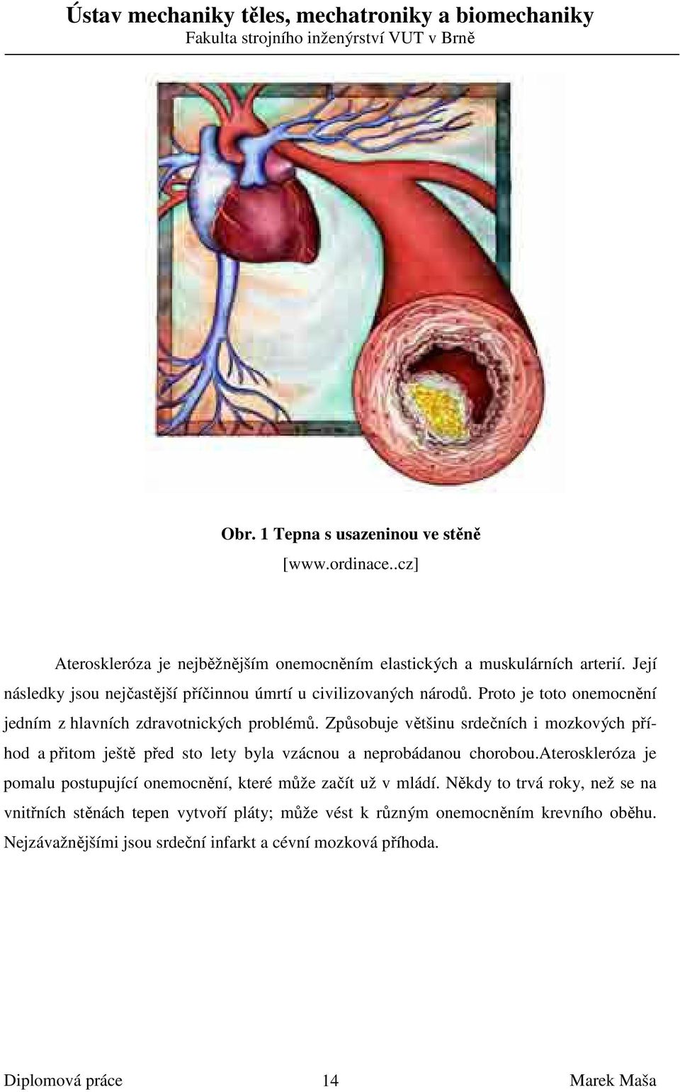 Způsobuje většinu srdečních i mozkových příhod a přitom ještě před sto lety byla vzácnou a neprobádanou chorobou.