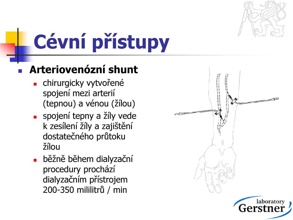 zesílení žíly a zajištění dostatečného průtoku žílou běžně během