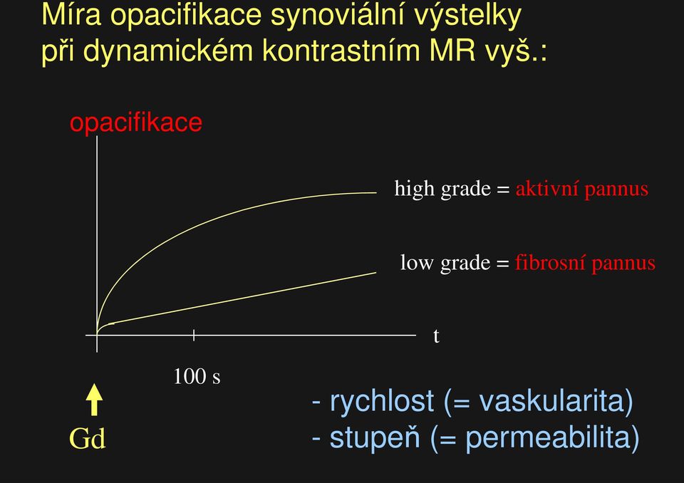 : opacifikace high grade = aktivní pannus low