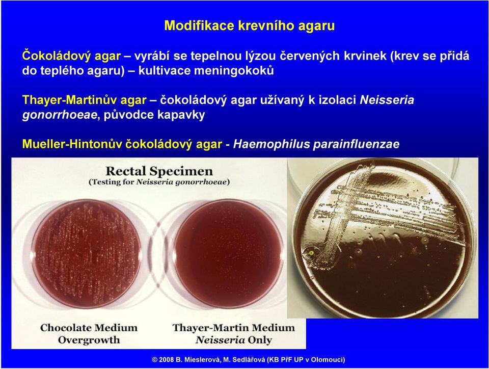Thayer-Martinův agar čokoládový agar užívaný k izolaci Neisseria