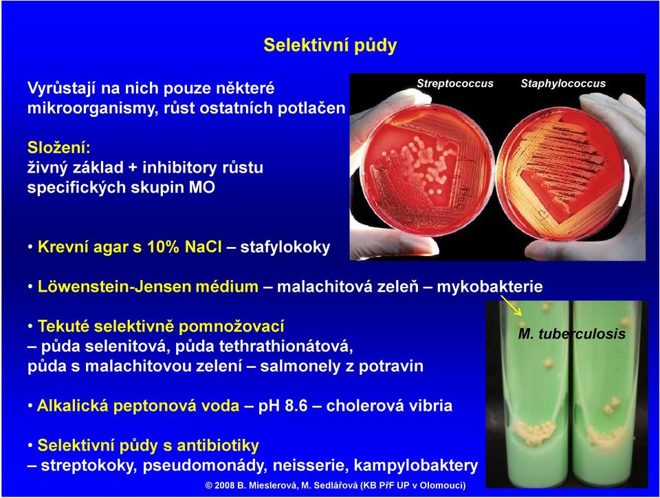 mykobakterie Tekuté selektivně pomnožovací půda selenitová, půda tethrathionátová, půda s malachitovou zelení salmonely z potravin M.