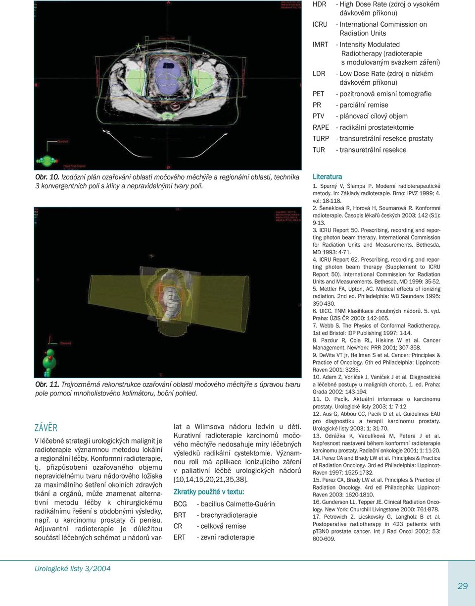 resekce prostaty - transuretrální resekce Obr. 10. Izodózní plán ozařování oblasti močového měchýře a regionální oblasti, technika 3 konvergentních polí s klíny a nepravidelnými tvary polí. Obr. 11.