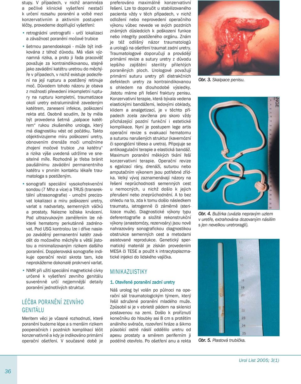 uretrografii - určí lokalizaci a závažnost poranění močové trubice šetrnou panendoskopii - může být indikována z téhož důvodu.