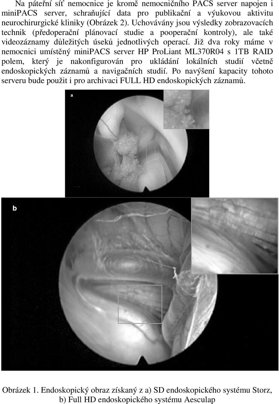 Již dva roky máme v nemocnici umístěný minipacs server HP ProLiant ML370R04 s 1TB RAID polem, který je nakonfigurován pro ukládání lokálních studií včetně endoskopických záznamů a