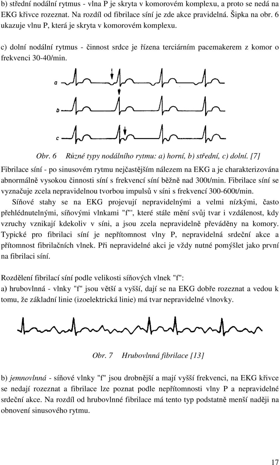 6 Různé typy nodálního rytmu: a) horní, b) střední, c) dolní.