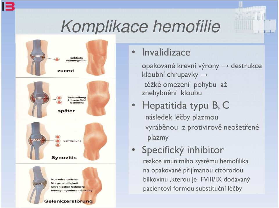 protivirově neošetřené plazmy Specifický inhibitor reakce imunitního systému hemofilika na