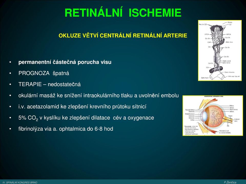 intraokulárního tlaku a uvo