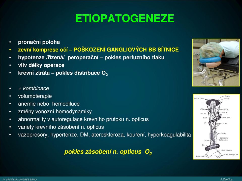 nebo hemodiluce změny venozní hemodynamiky abnormality v autoregulace krevního průtoku n.