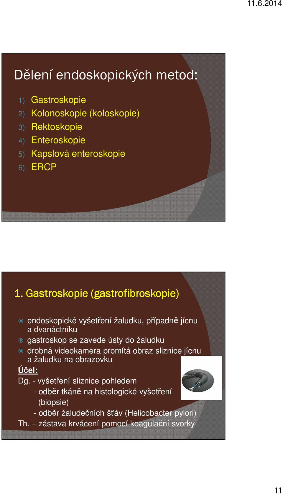 Gastroskopie (gastrofibroskopie) endoskopické vyšetření žaludku, případně jícnu a dvanáctníku gastroskop se zavede ústy do žaludku