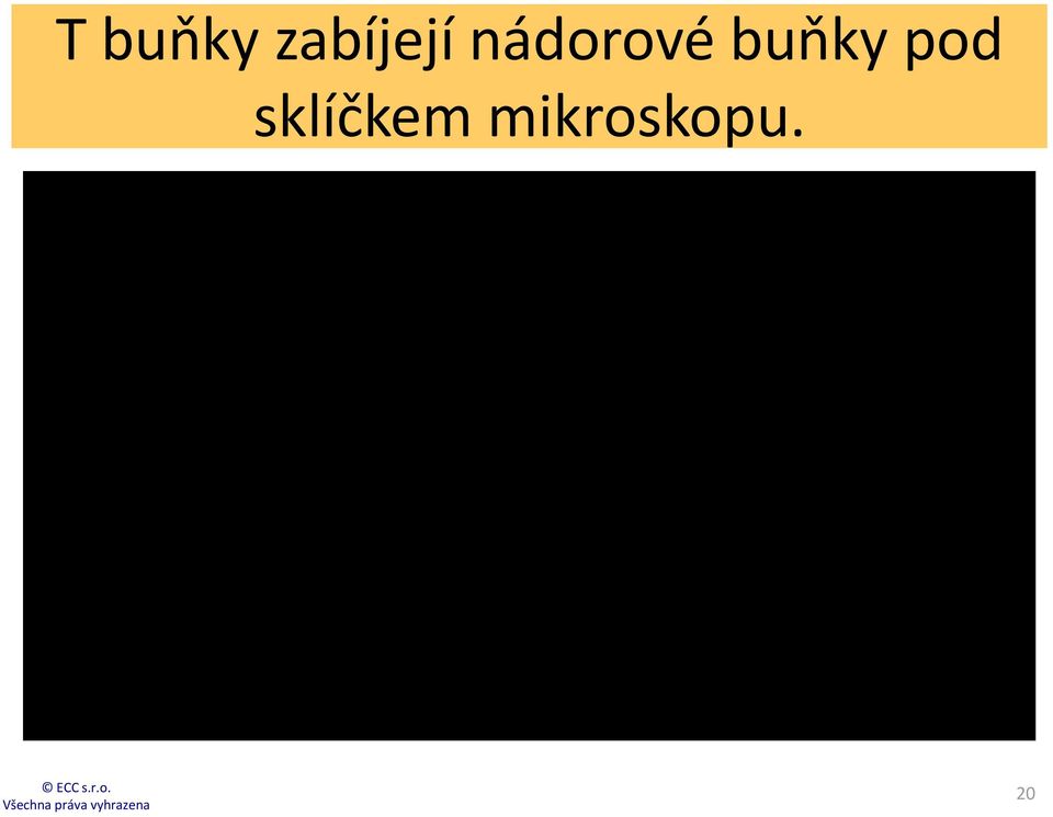 nádorové buňky