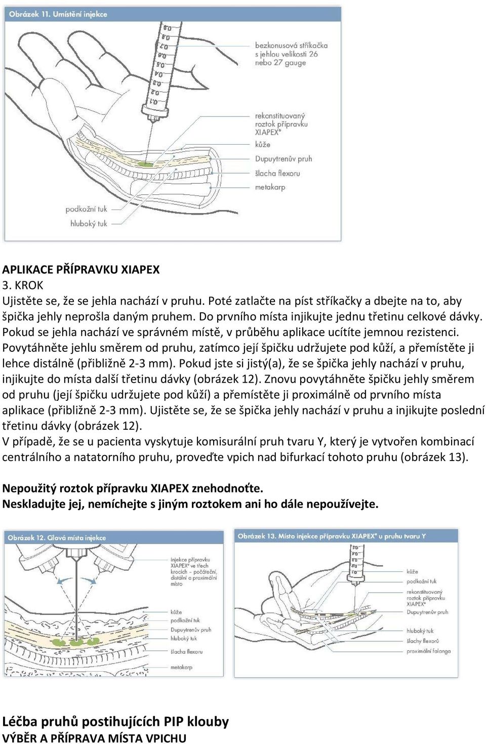 Povytáhněte jehlu směrem od pruhu, zatímco její špičku udržujete pod kůží, a přemístěte ji lehce distálně (přibližně 2 3 mm).