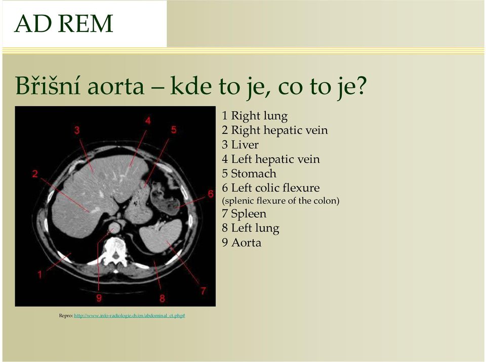 5 Stomach 6 Left colic flexue (splenic flexue of the colon)