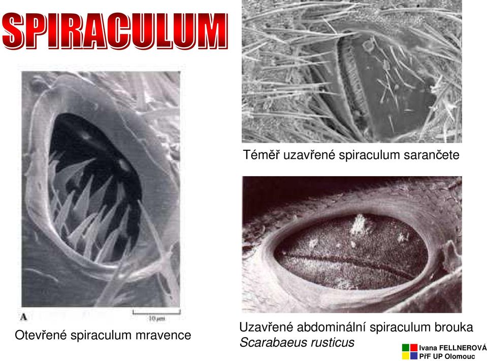 mravence Uzavřené abdominální