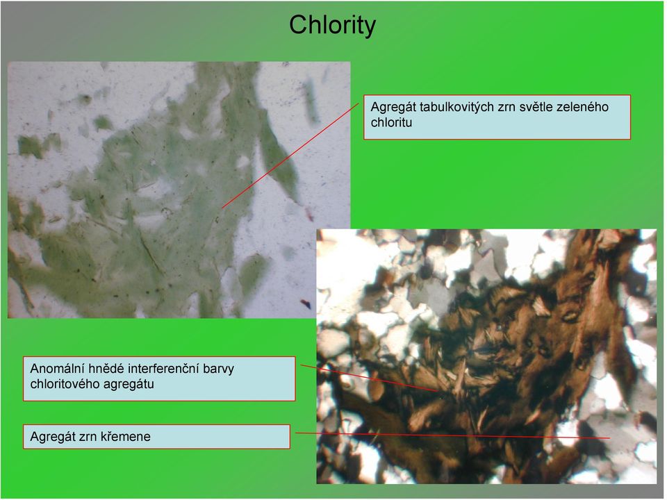 Anomální hnědé interferenční