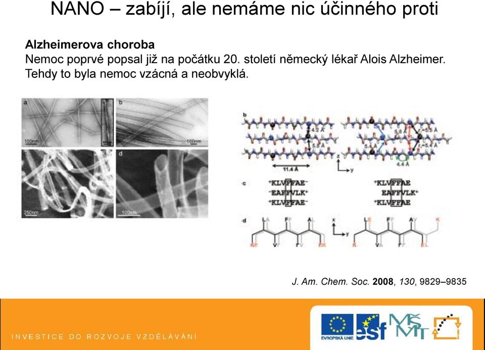 počátku 20. století německý lékař Alois Alzheimer.