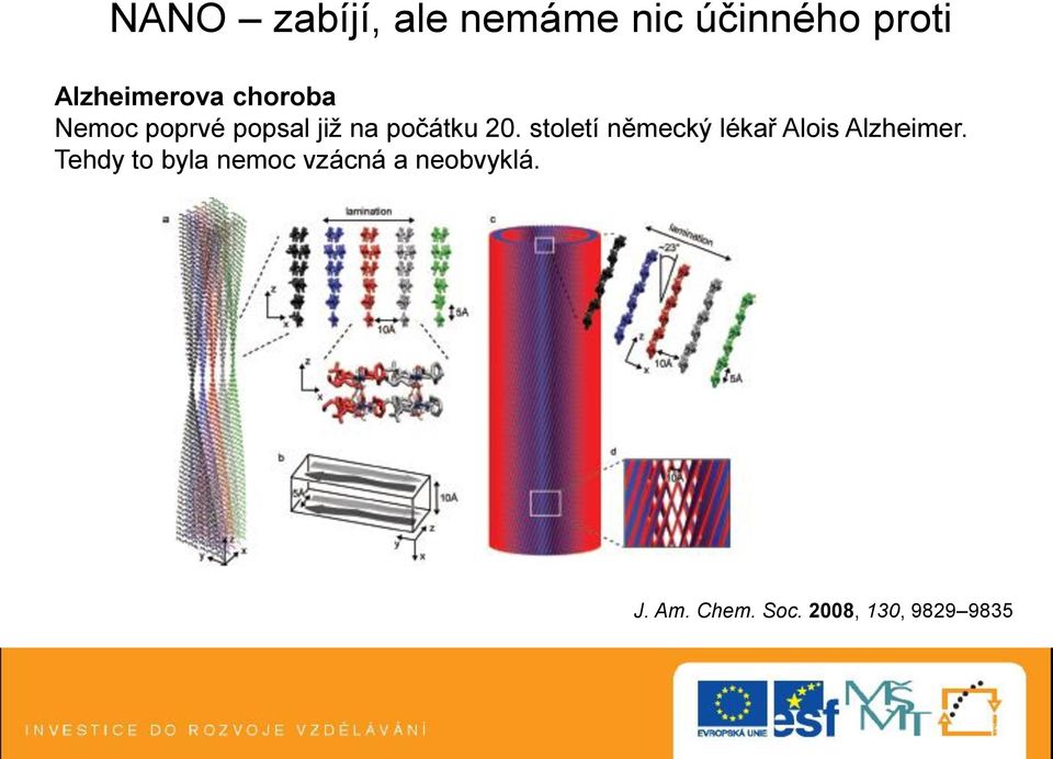 počátku 20. století německý lékař Alois Alzheimer.