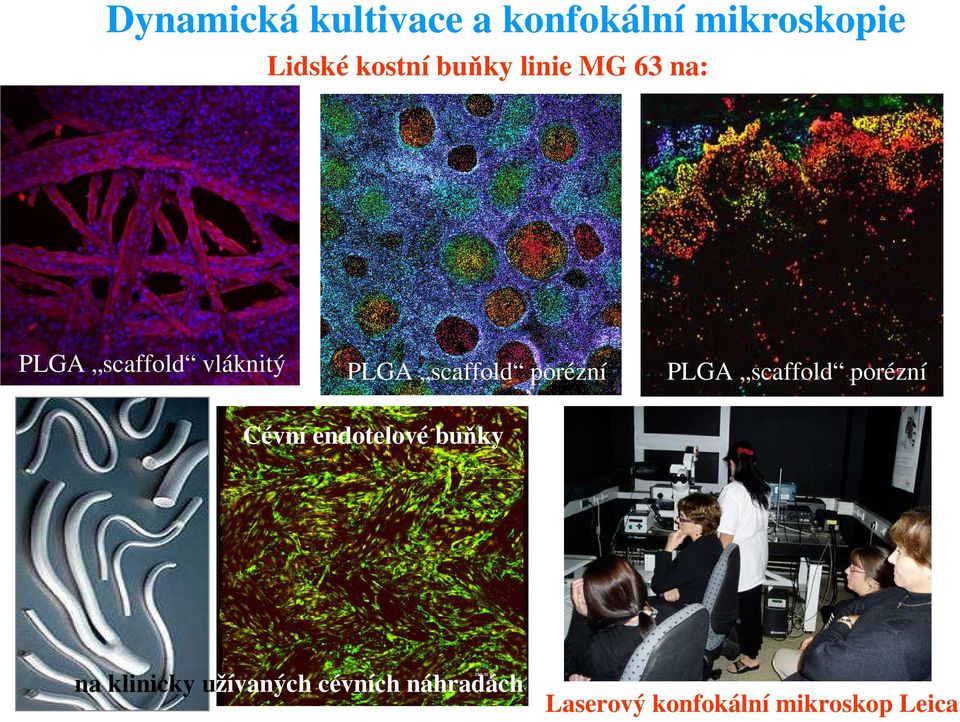 porézní PLGA scaffold porézní Cévní endotelové buňky na