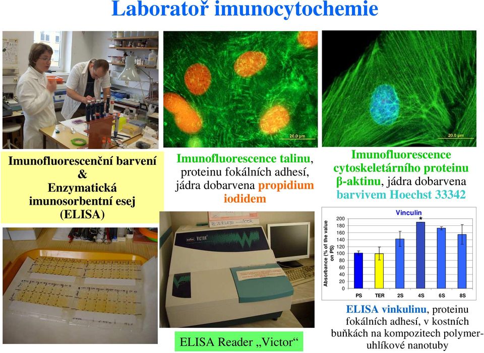 Imunofluorescence cytoskeletárního proteinu β-aktinu, jádra dobarvena barvivem Hoechst 33342 200 180 160 140 120 100 80 60