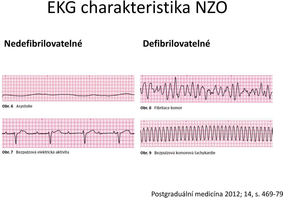 Defibrilovatelné