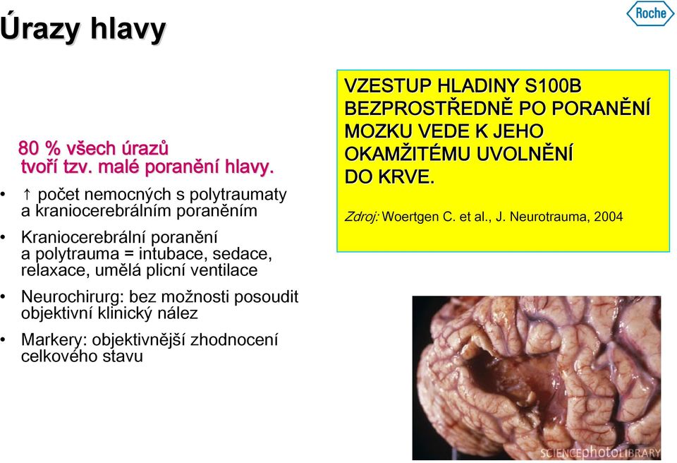 relaxace, umělá plicní ventilace Neurochirurg: bez možnosti posoudit objektivní klinický nález Markery: objektivnější