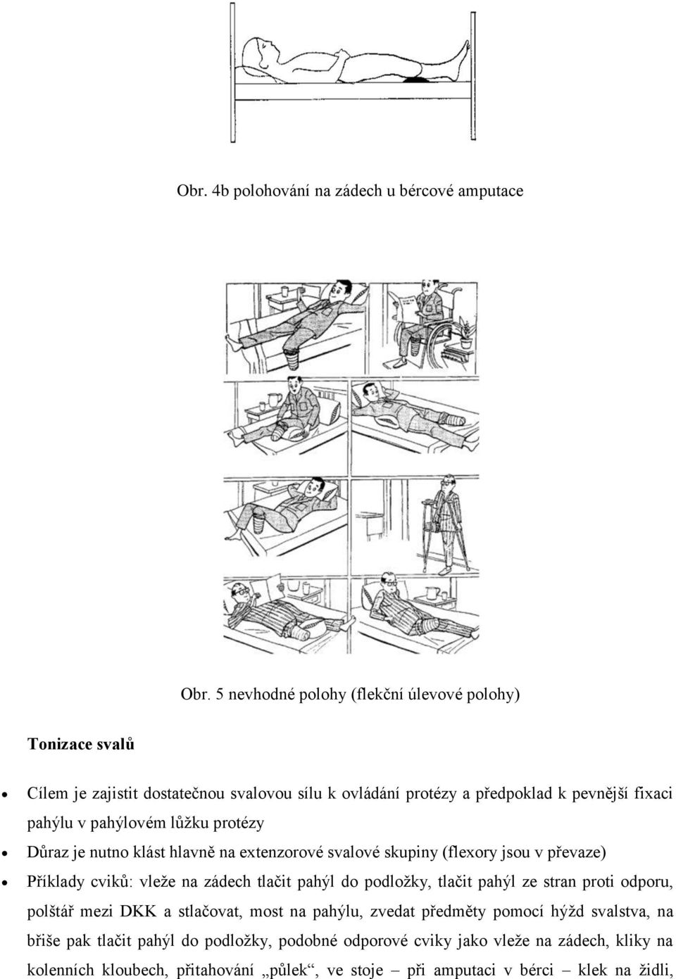 pahýlovém lůžku protézy Důraz je nutno klást hlavně na extenzorové svalové skupiny (flexory jsou v převaze) Příklady cviků: vleže na zádech tlačit pahýl do podložky,