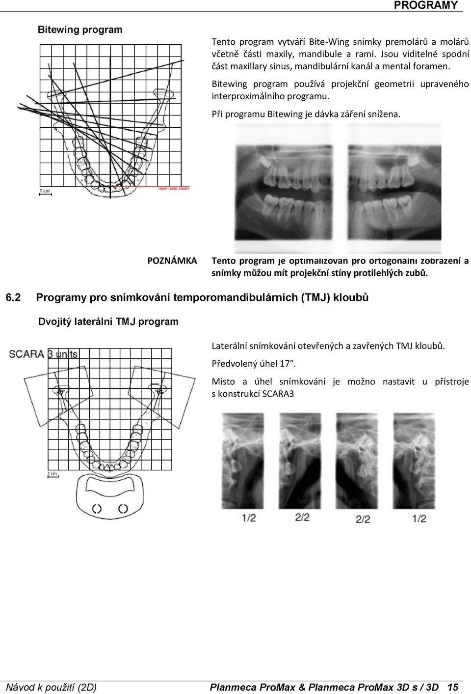 Při programu Bitewing je dávka záření snížena. Tento program je optimalizován pro ortogonální zobrazení a snímky můžou mít projekční stíny protilehlých zubů. 6.