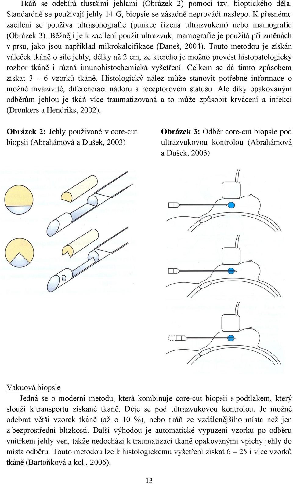 Běţněji je k zacílení pouţit ultrazvuk, mamografie je pouţitá při změnách v prsu, jako jsou například mikrokalcifikace (Daneš, 2004).