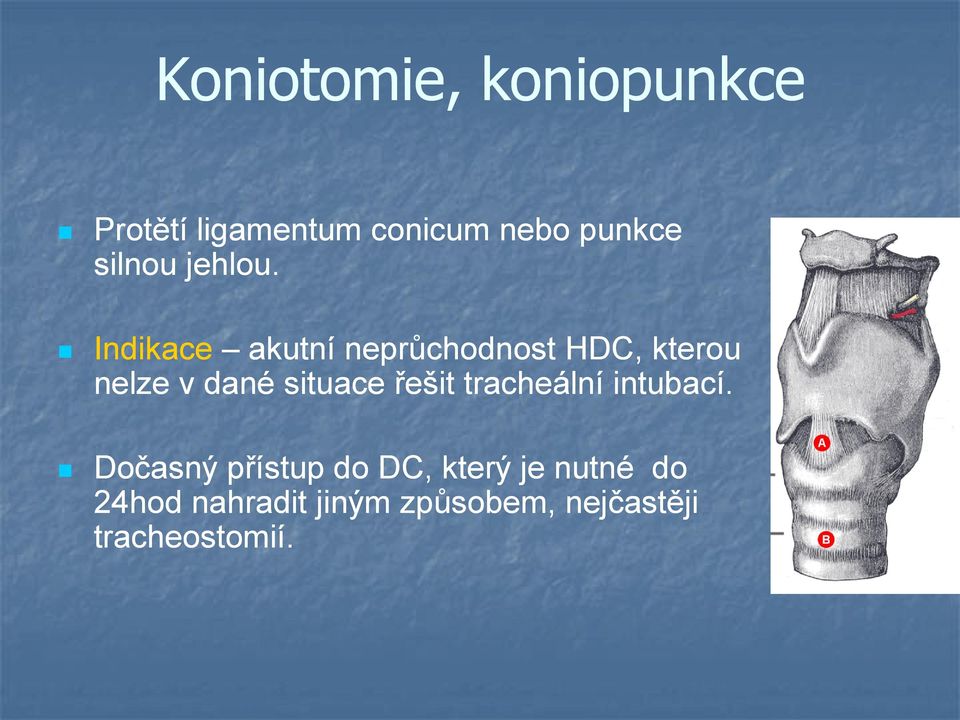 Indikace akutní neprůchodnost HDC, kterou nelze v dané situace