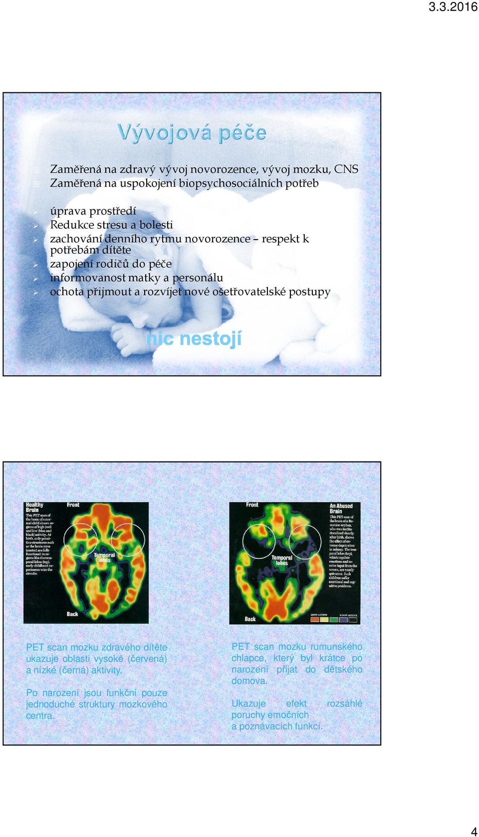 postupy PET scan mozku zdravého dítěte ukazuje oblasti vysoké (červená) a nízké (černá) aktivity.