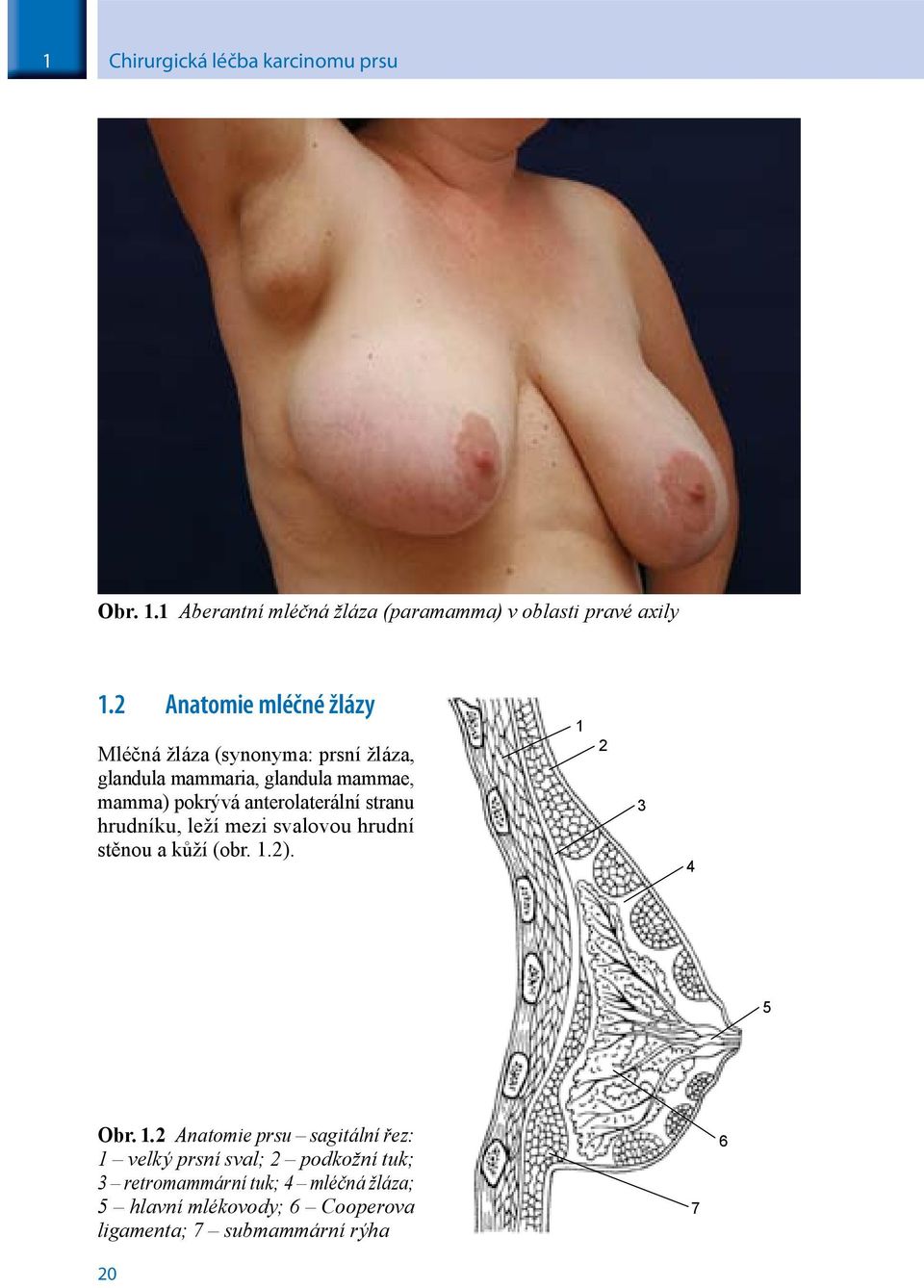 anterolaterální stranu hrudníku, leží mezi svalovou hrudní stěnou a kůží (obr. 1.